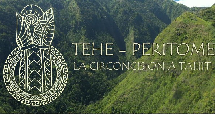 Tehe – Peritome